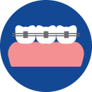 علم تقويم الأسنان المعوجة